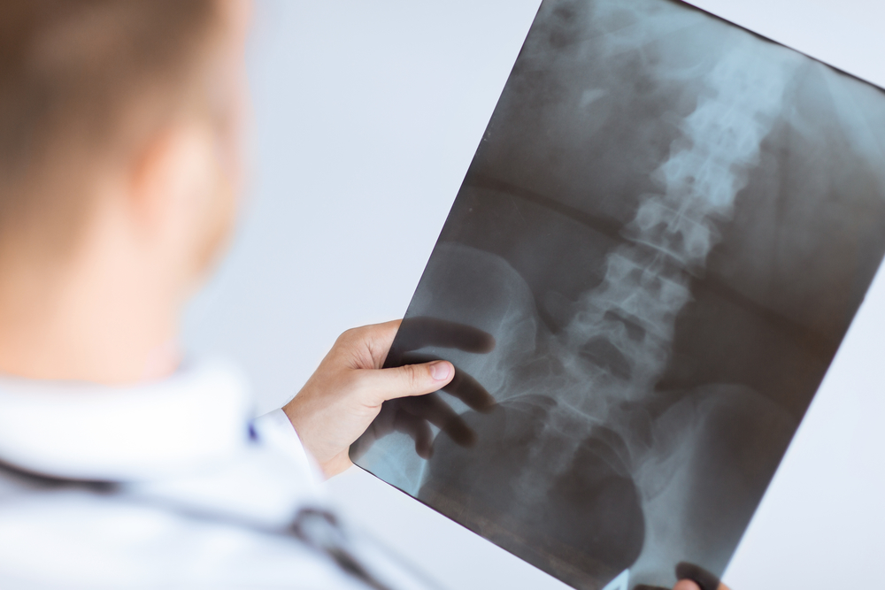 How a Chiropractic Billing Service Can Save You Money - doctor holding x-ray or roentgen image