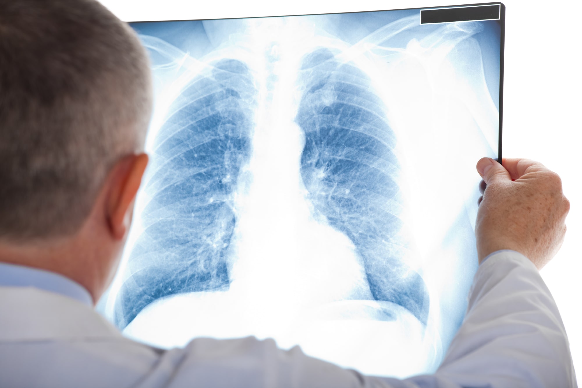 Spinal & Postural Screenings