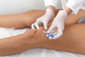 Types of Auto Accident Injuries We Treat in Takoma Park